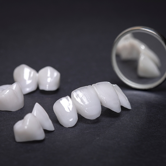 Close up of dental restorations lying next to dental mirror