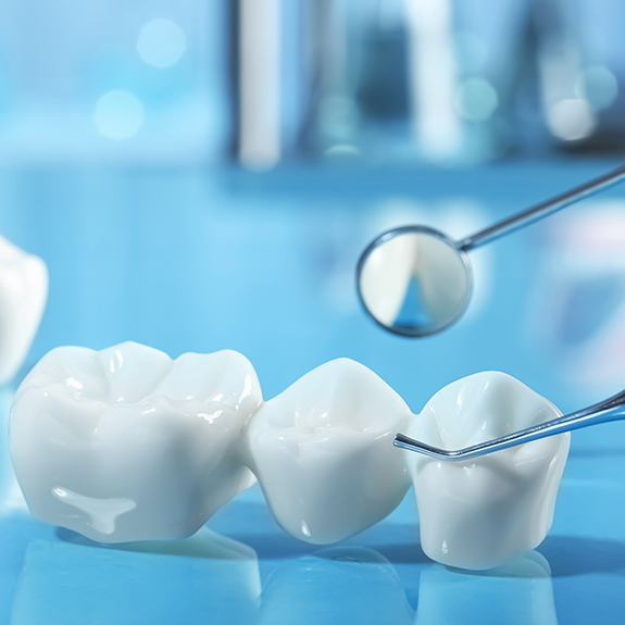 Close up of dental bridge in Reynoldsburg on blue surface with dental instruments