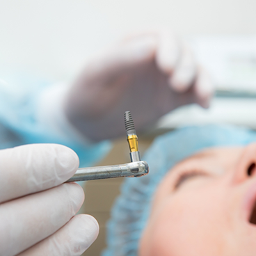 Close up of dentist holding a dental implant post