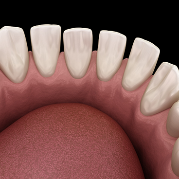 Illustration of gapped teeth