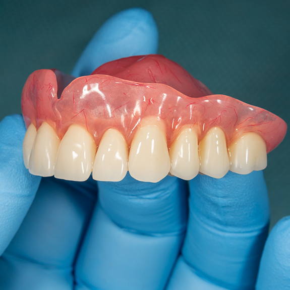 Close up of gloved hand holding dentures