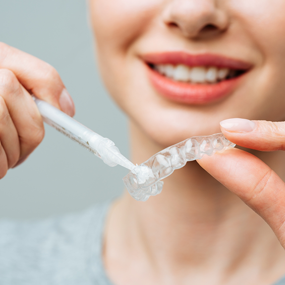 Close up of woman filling tray with teeth whitening gel