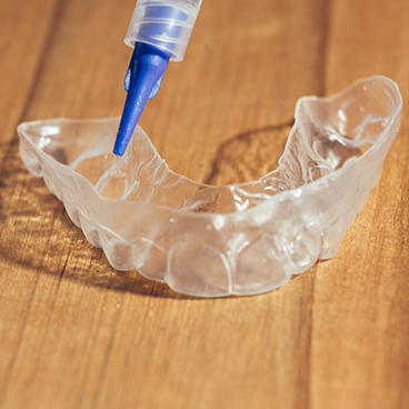 Tray being filled with teeth whitening gel