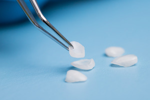 Tweezers being used to pick up one of several veneers